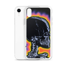 Load image into Gallery viewer, Matching iPhone Case Set - Left Side